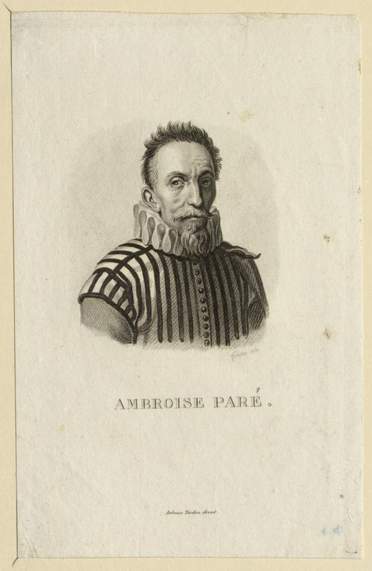 Paré, Ambroise